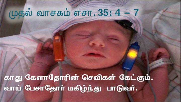 வானத்தை அண்ணாந்து பார்த்து, பெருமூச்சு விட்டு, அவரை நோக்கி எப்பத்தா அதாவது திறக்கப்படு  என்றார்.