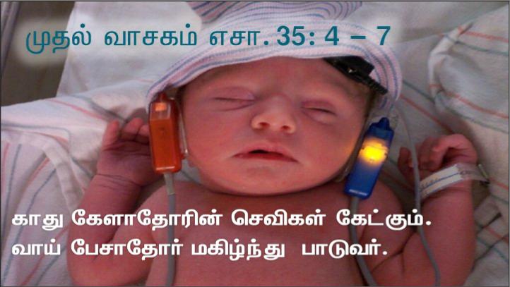 காது கேளாதவரும் திக்கிப்பேசுபவருமான ஒருவரைச் சிலர் அவரிடம் கொண்டு வந்து,
 அவர்மீது கைவைத்துக் குணமாக்குமாறு அவரை வேண்டிக் கொண்டனர்..